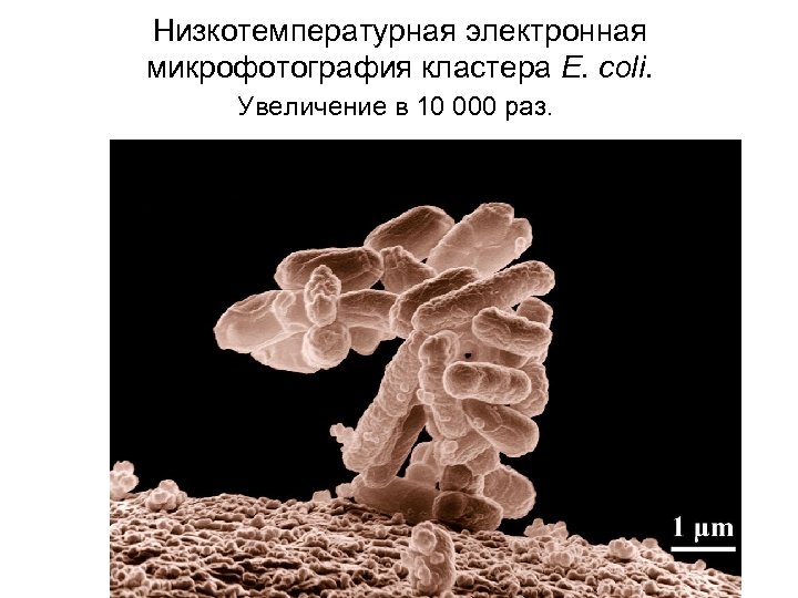 Низкотемпературная электронная микрофотография кластера E. coli. Увеличение в 10 000 раз. 