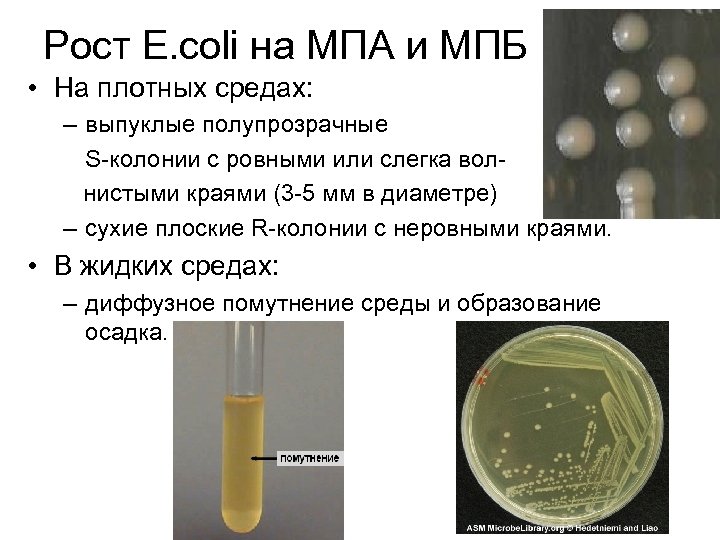 Что такое бульон в микробиологии