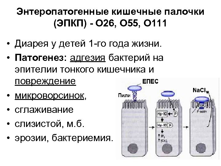 Энтеропатогенные кишечные палочки (ЭПКП) - О 26, О 55, О 111 • Диарея у