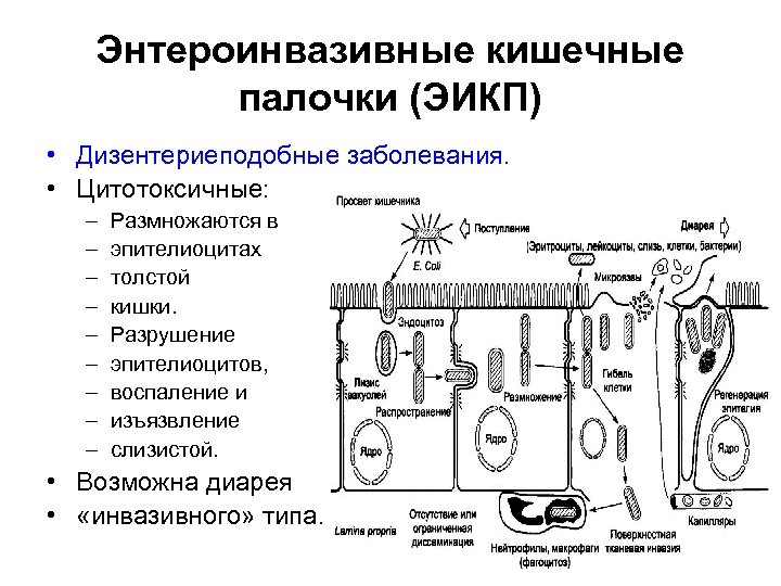 Энтероинвазивные кишечные палочки (ЭИКП) • Дизентериеподобные заболевания. • Цитотоксичные: – – – – –