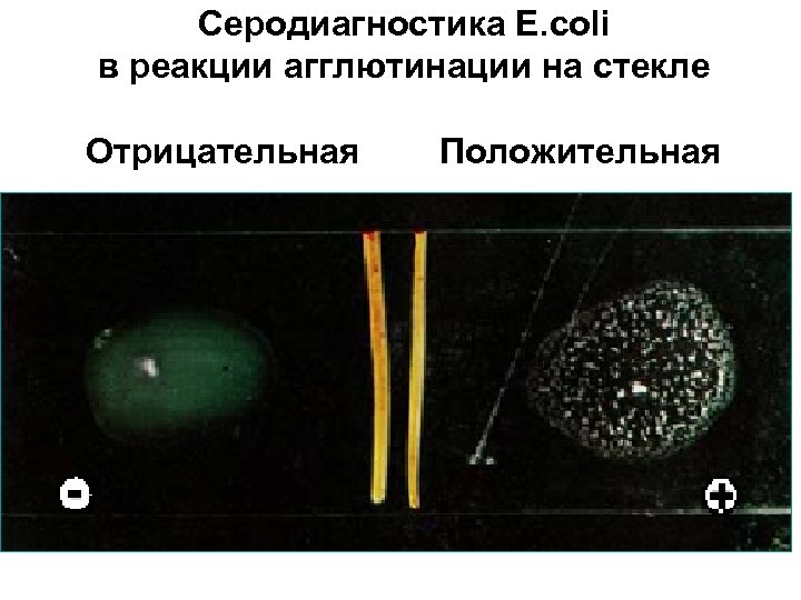 Реакция агглютинации на стекле микробиология схема и механизм