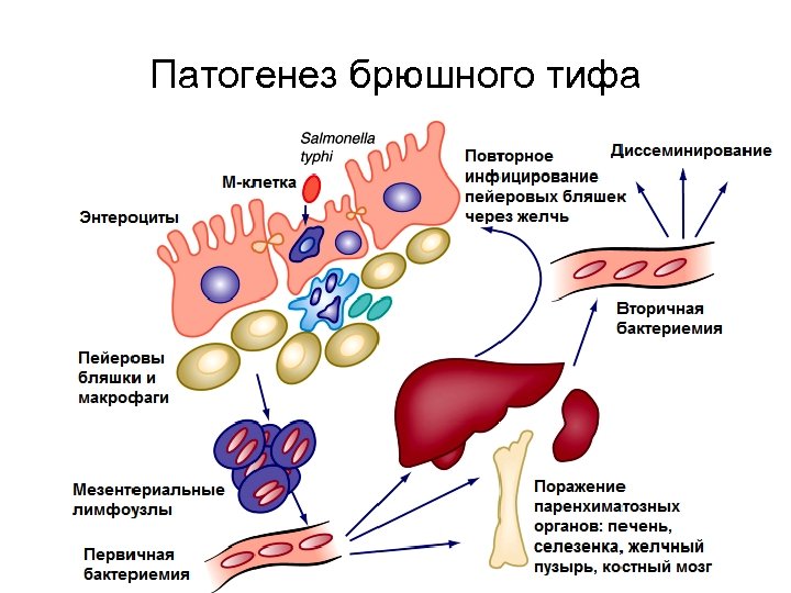 Патогенез брюшного тифа 