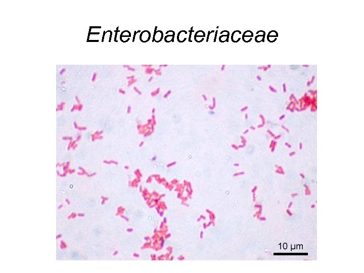 Enterobacteriaceae 
