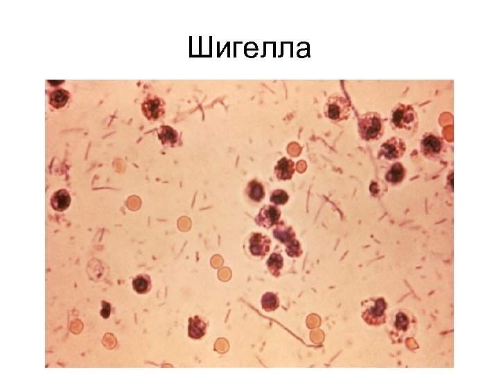 Шигелла 
