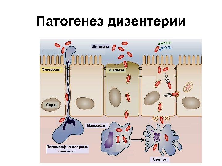 Патогенез дизентерии 