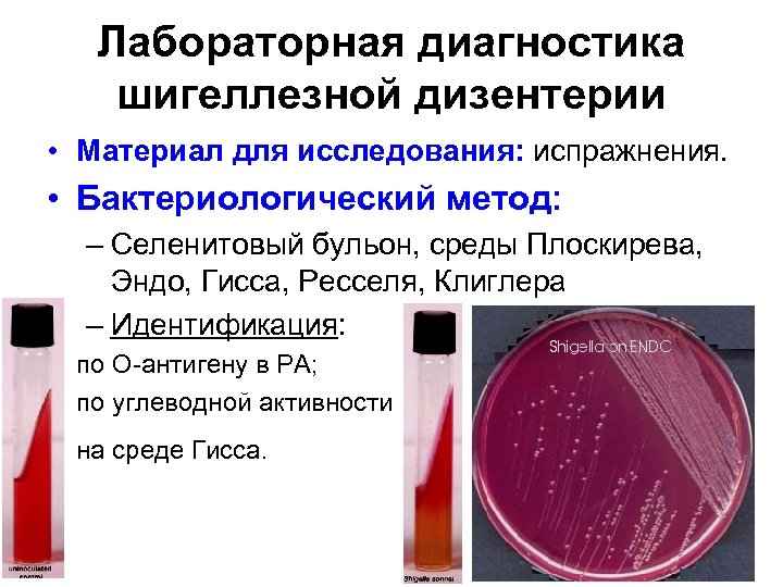 Лабораторная диагностика шигеллезной дизентерии • Материал для исследования: испражнения. • Бактериологический метод: – Селенитовый