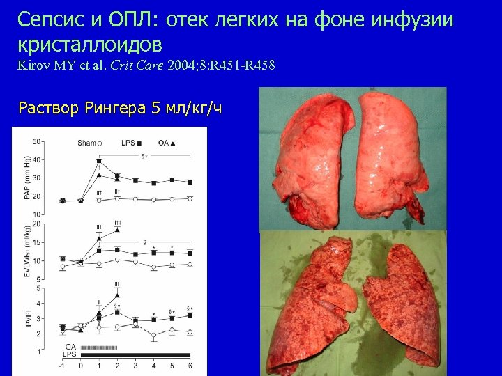 Cепсис и ОПЛ: отек легких на фоне инфузии кристаллоидов Kirov MY et al. Crit