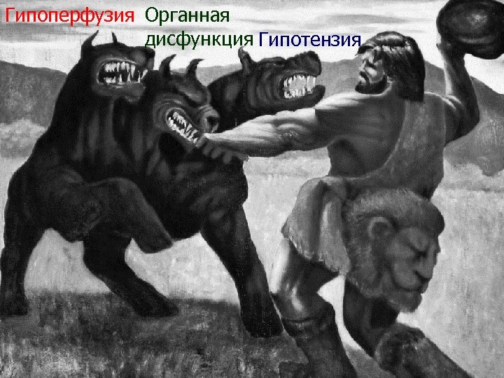 Гипоперфузия Органная дисфункция Гипотензия 