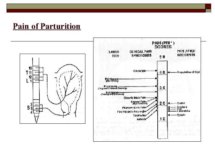 Pain of Parturition 