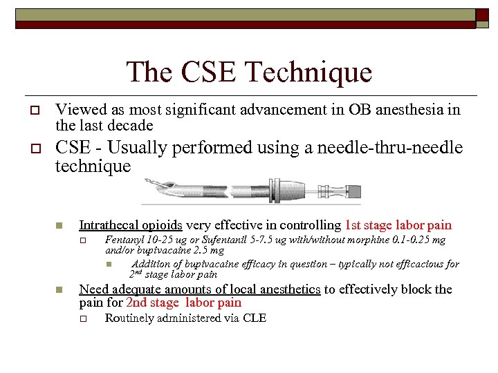The CSE Technique o Viewed as most significant advancement in OB anesthesia in the