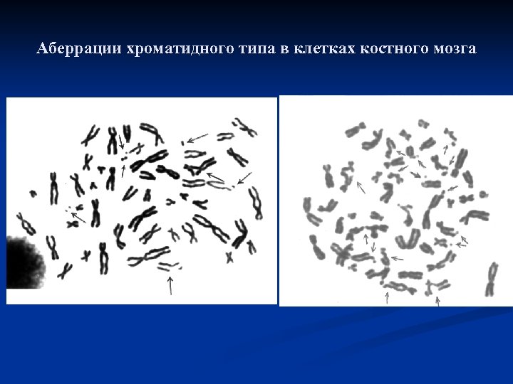 Аберрации хроматидного типа в клетках костного мозга 