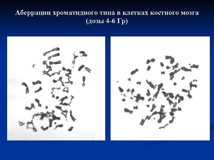 Аберрации хроматидного типа в клетках костного мозга (дозы 4 -6 Гр) 