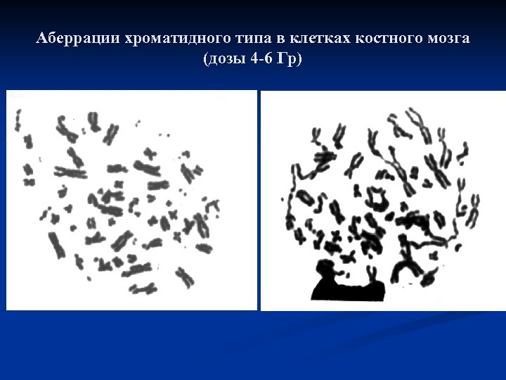 Аберрации хроматидного типа в клетках костного мозга (дозы 4 -6 Гр) 