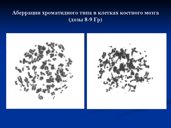 Аберрации хроматидного типа в клетках костного мозга (дозы 8 -9 Гр) 