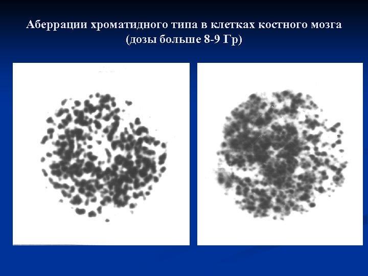 Аберрации хроматидного типа в клетках костного мозга (дозы больше 8 -9 Гр) 