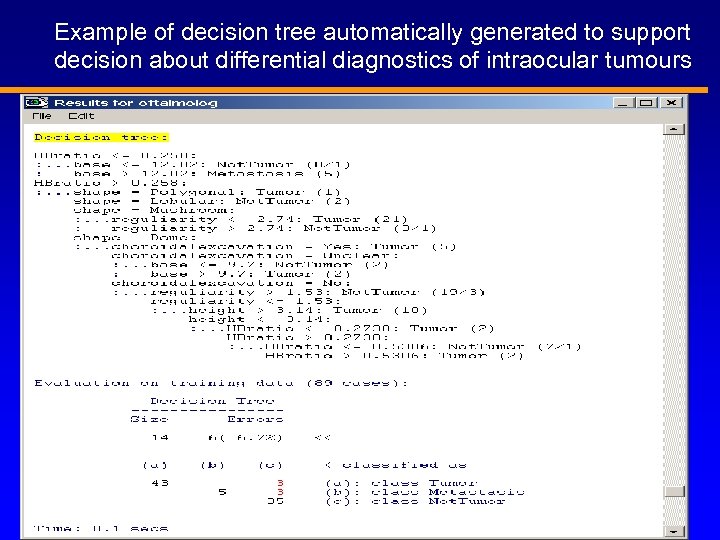 Example of decision tree automatically generated to support decision about differential diagnostics of intraocular
