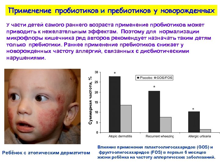 Применение пробиотиков и пребиотиков у новорожденных У части детей самого раннего возраста применение пробиотиков