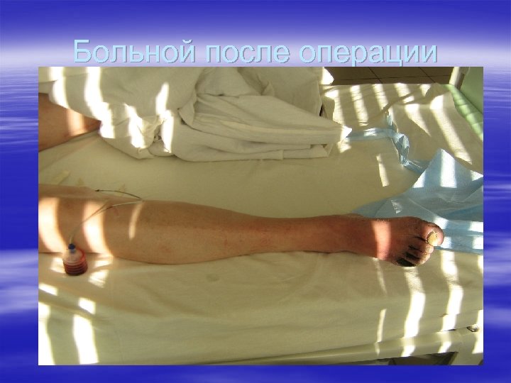 Больной после операции 