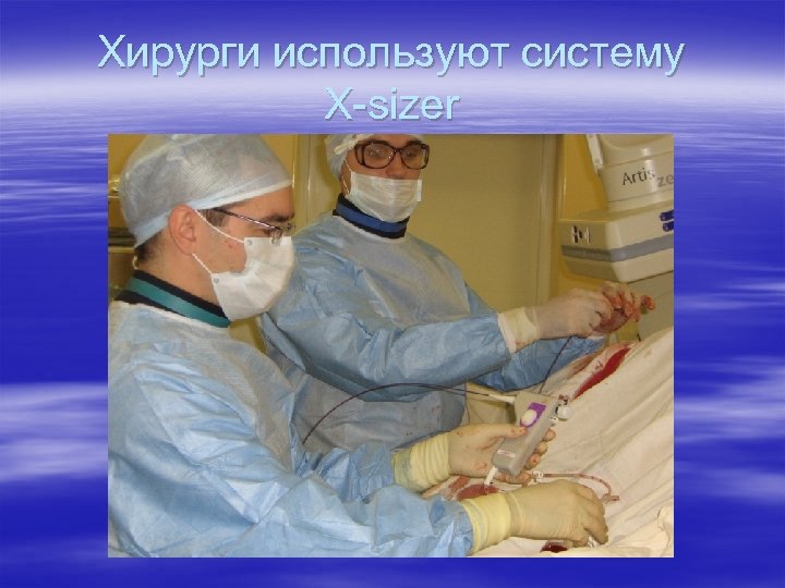 Хирурги используют систему X-sizer 