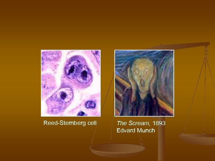 Reed-Sternberg cell The Scream, 1893 Edvard Munch 