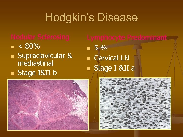 Hodgkin’s Disease Nodular Sclerosing n < 80% n Supraclavicular & mediastinal n Stage I&II