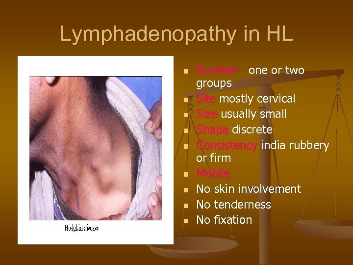 Lymphadenopathy in HL n n n n n Number one or two groups Site