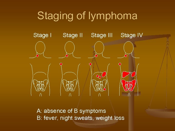 Staging of lymphoma Stage III Stage IV A: absence of B symptoms B: fever,