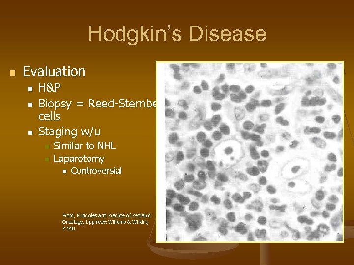 Hodgkin’s Disease n Evaluation n H&P Biopsy = Reed-Sternberg cells Staging w/u n n