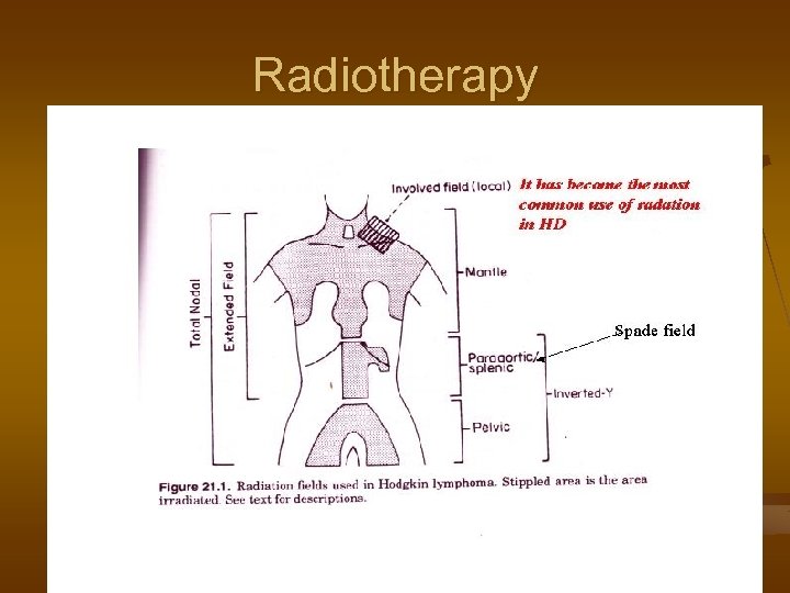 Radiotherapy 