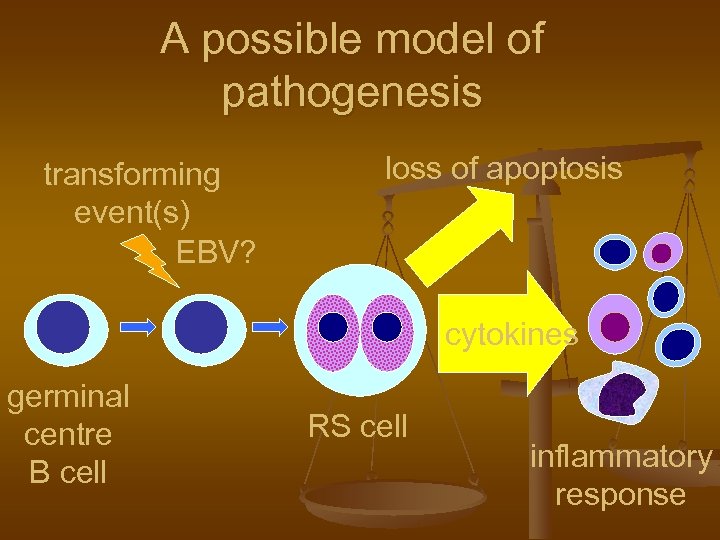 A possible model of pathogenesis transforming event(s) EBV? loss of apoptosis cytokines germinal centre