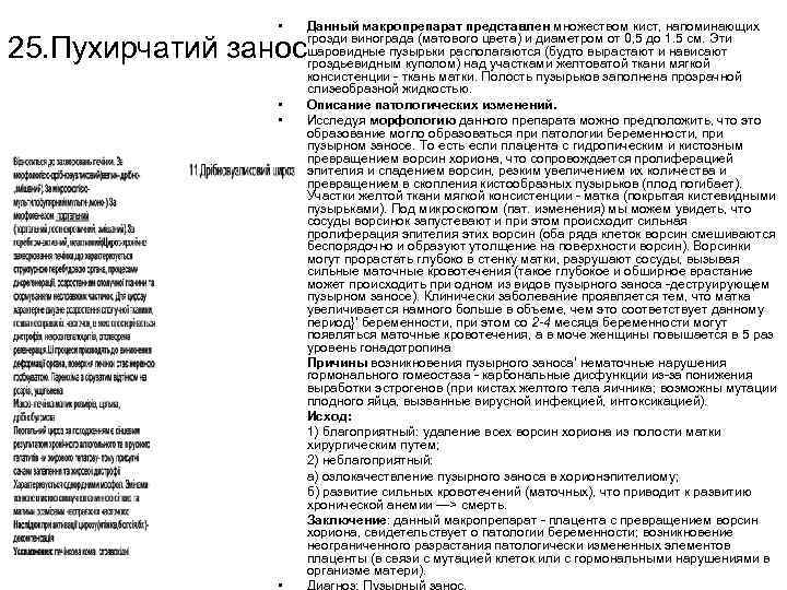  • 25. Пухирчатий занос • • • Данный макропрепарат представлен множеством кист, напоминающих