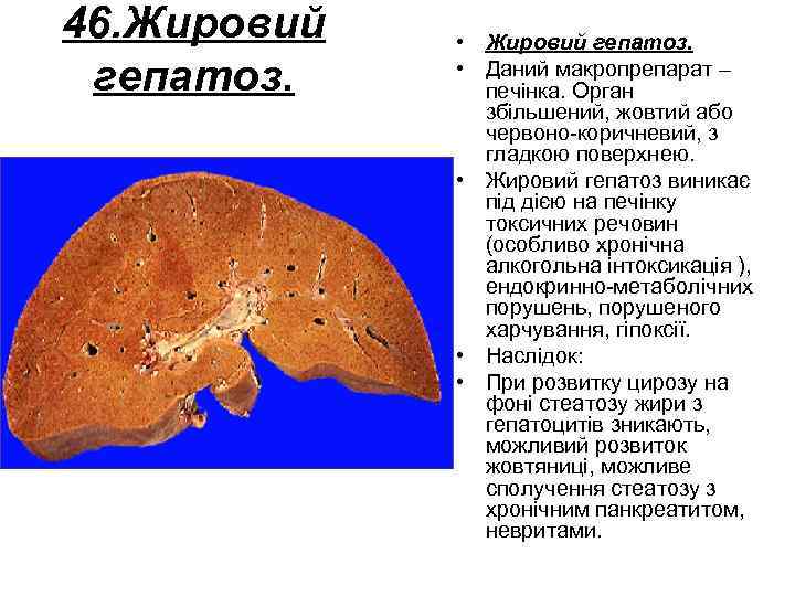 46. Жировий гепатоз. • Даний макропрепарат – печінка. Орган збільшений, жовтий або червоно коричневий,