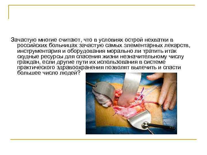 Зачастую многие считают, что в условиях острой нехватки в российских больницах зачастую самых элементарных