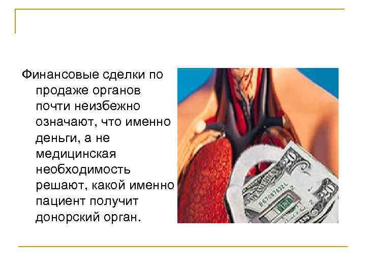 Продать органы