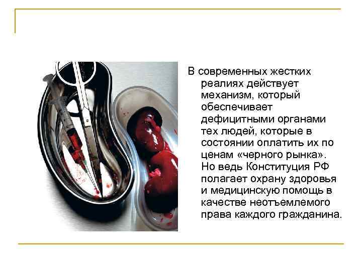 В современных жестких реалиях действует механизм, который обеспечивает дефицитными органами тех людей, которые в