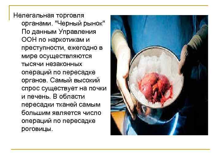 Нелегальная торговля органами. "Черный рынок" По данным Управления ООН по наркотикам и преступности, ежегодно