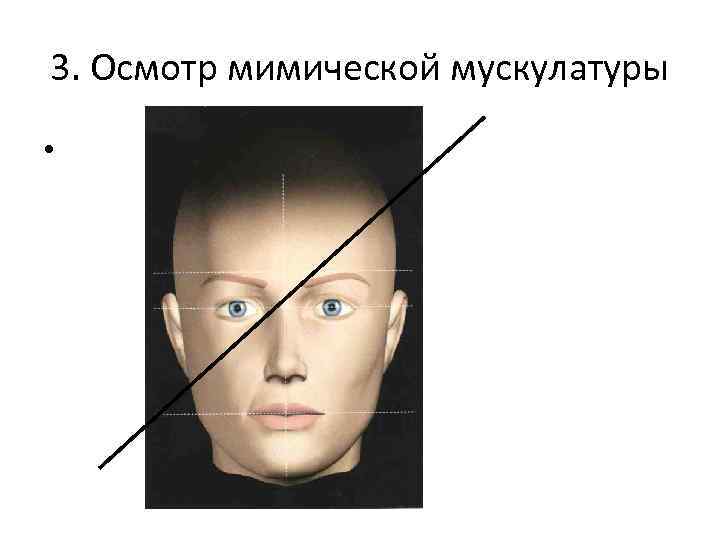 3. Осмотр мимической мускулатуры • 