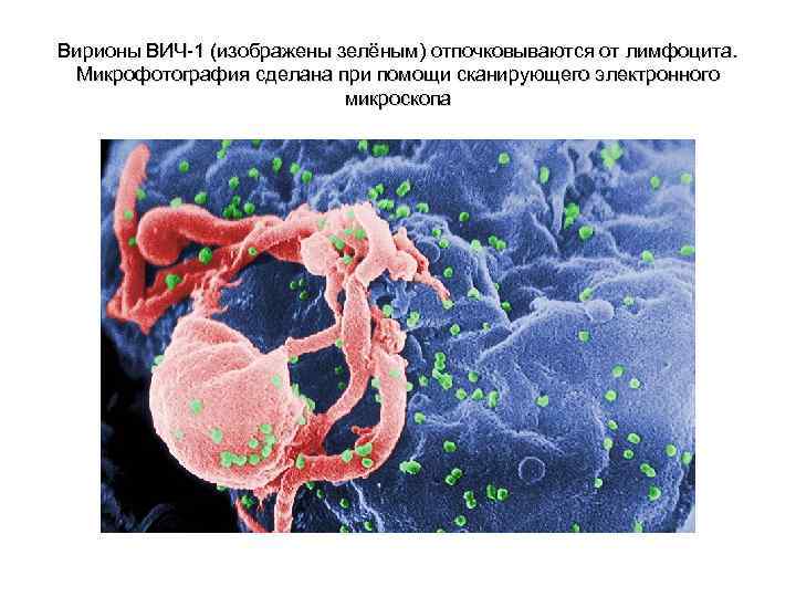 Вирионы ВИЧ-1 (изображены зелёным) отпочковываются от лимфоцита. Микрофотография сделана при помощи сканирующего электронного микроскопа