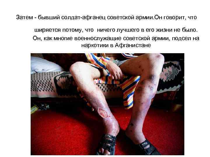 Затем - бывший солдат-афганец советской армии. Он говорит, что ширяется потому, что ничего лучшего