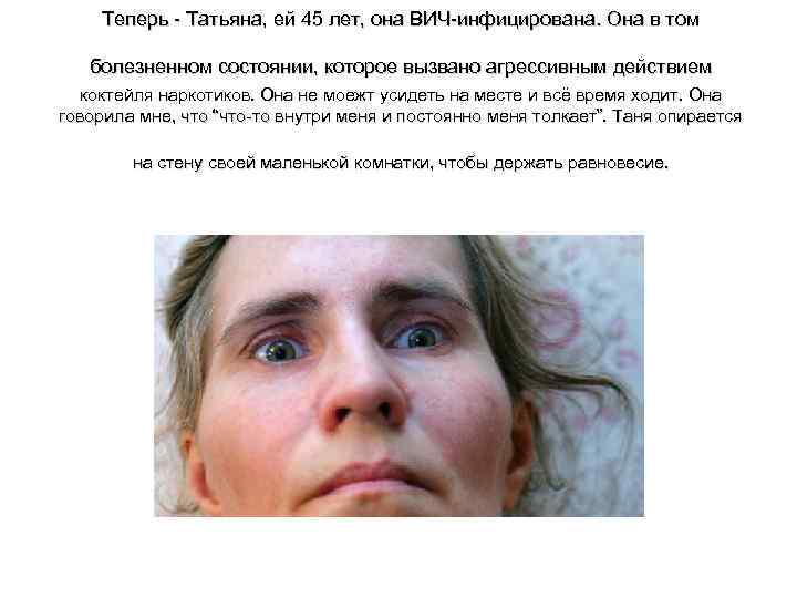 Теперь - Татьяна, ей 45 лет, она ВИЧ-инфицирована. Она в том болезненном состоянии, которое