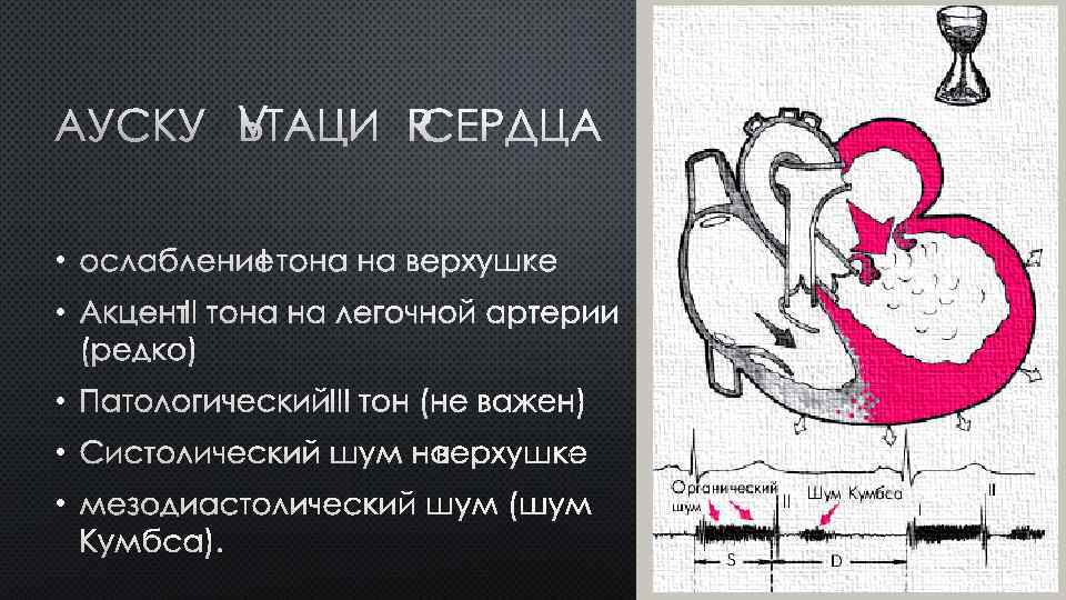 АУСКУЛЬТАЦИЯ СЕРДЦА • ОСЛАБЛЕНИЕ I ТОНА НА ВЕРХУШКЕ • АКЦЕНТ II ТОНА НА ЛЕГОЧНОЙ