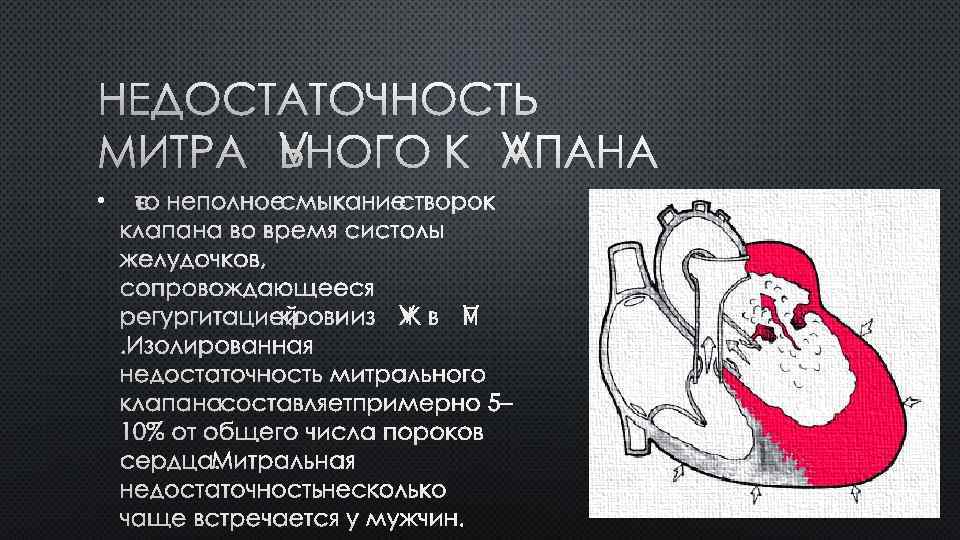 НЕДОСТАТОЧНОСТЬ МИТРАЛЬНОГО КЛАПАНА • ЭТО НЕПОЛНОЕ СМЫКАНИЕ СТВОРОК КЛАПАНА ВО ВРЕМЯ СИСТОЛЫ ЖЕЛУДОЧКОВ, СОПРОВОЖДАЮЩЕЕСЯ