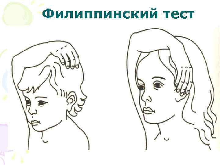 Филиппинский тест 