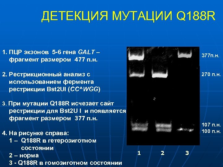 ДЕТЕКЦИЯ МУТАЦИИ Q 188 R 1. ПЦР экзонов 5 -6 гена GALT – фрагмент