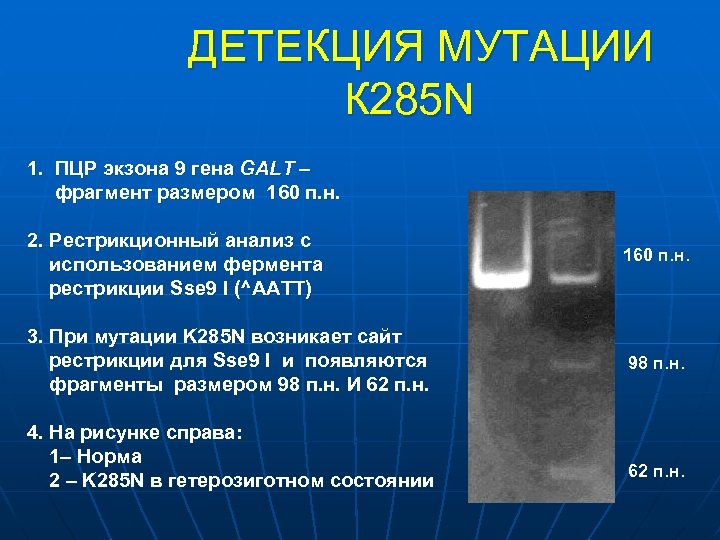 ДЕТЕКЦИЯ МУТАЦИИ К 285 N 1. ПЦР экзона 9 гена GALT – фрагмент размером