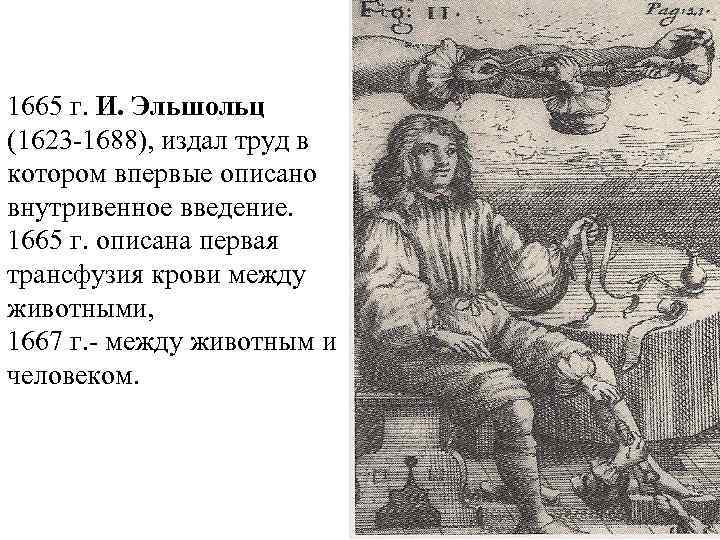 1665 г. И. Эльшольц (1623 -1688), издал труд в котором впервые описано внутривенное введение.