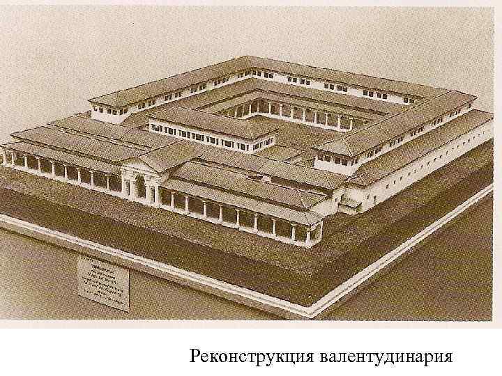 Реконструкция валентудинария 