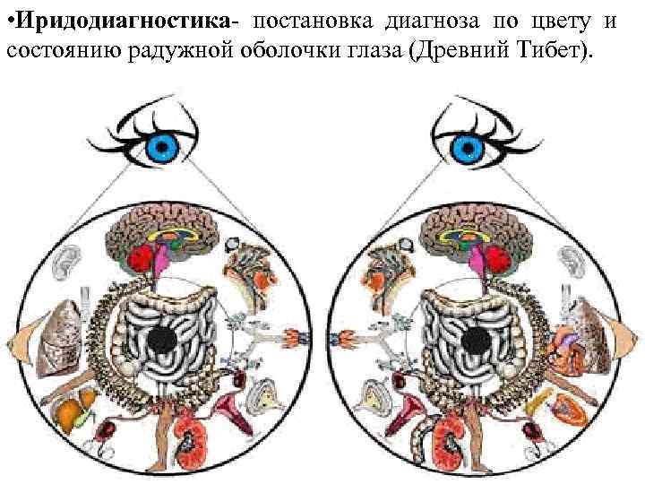  • Иридодиагностика- постановка диагноза по цвету и состоянию радужной оболочки глаза (Древний Тибет).