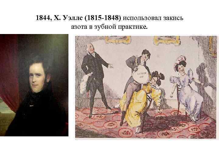 1844, Х. Уэллс (1815 -1848) использовал закись азота в зубной практике. 