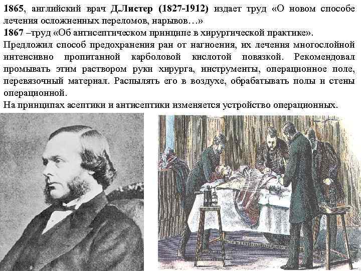 1865, английский врач Д. Листер (1827 -1912) издает труд «О новом способе лечения осложненных